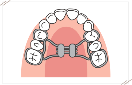 顎顔面矯正に使用する装置