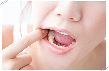 見た目による心理的ストレス